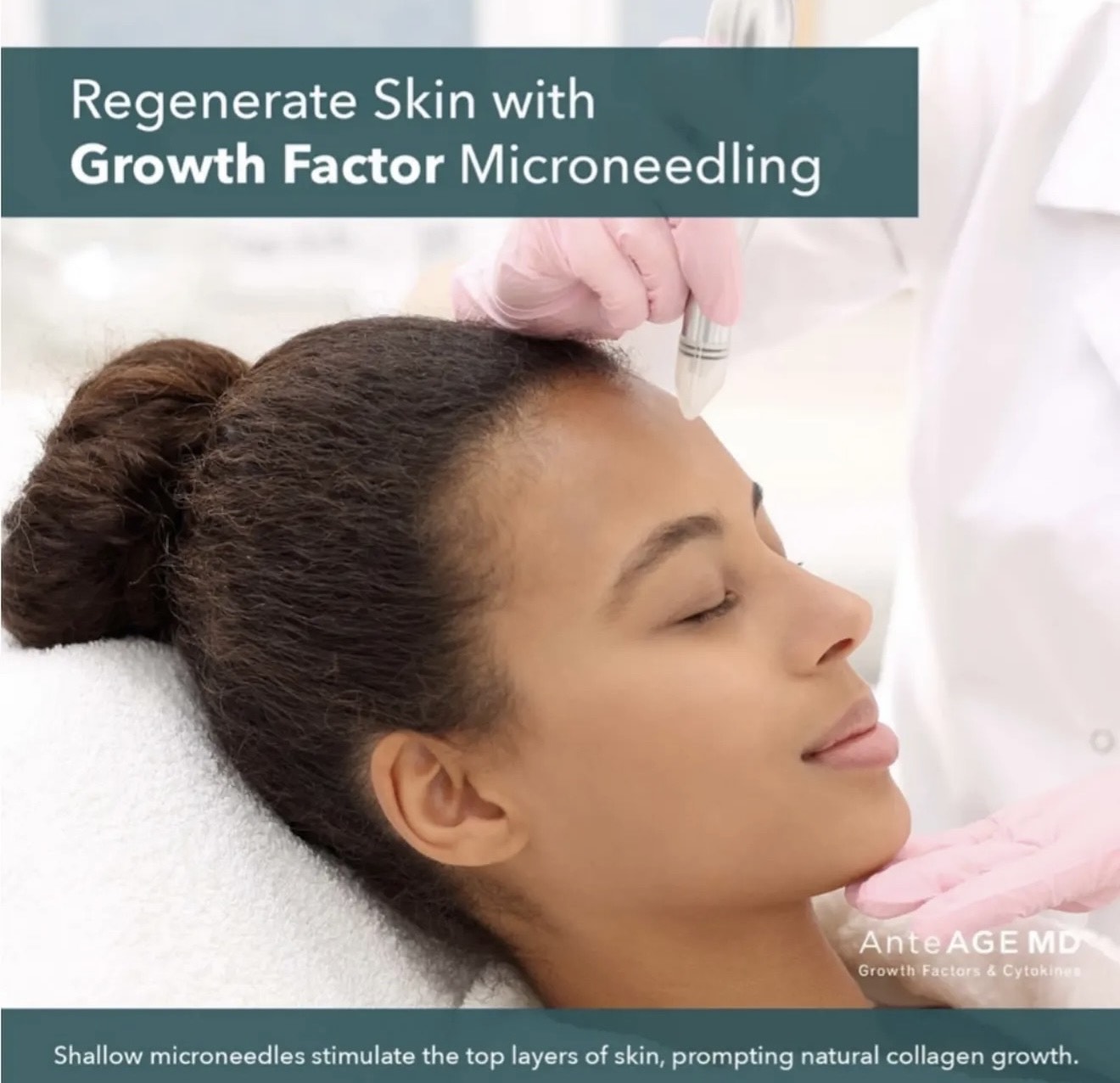 microneedling